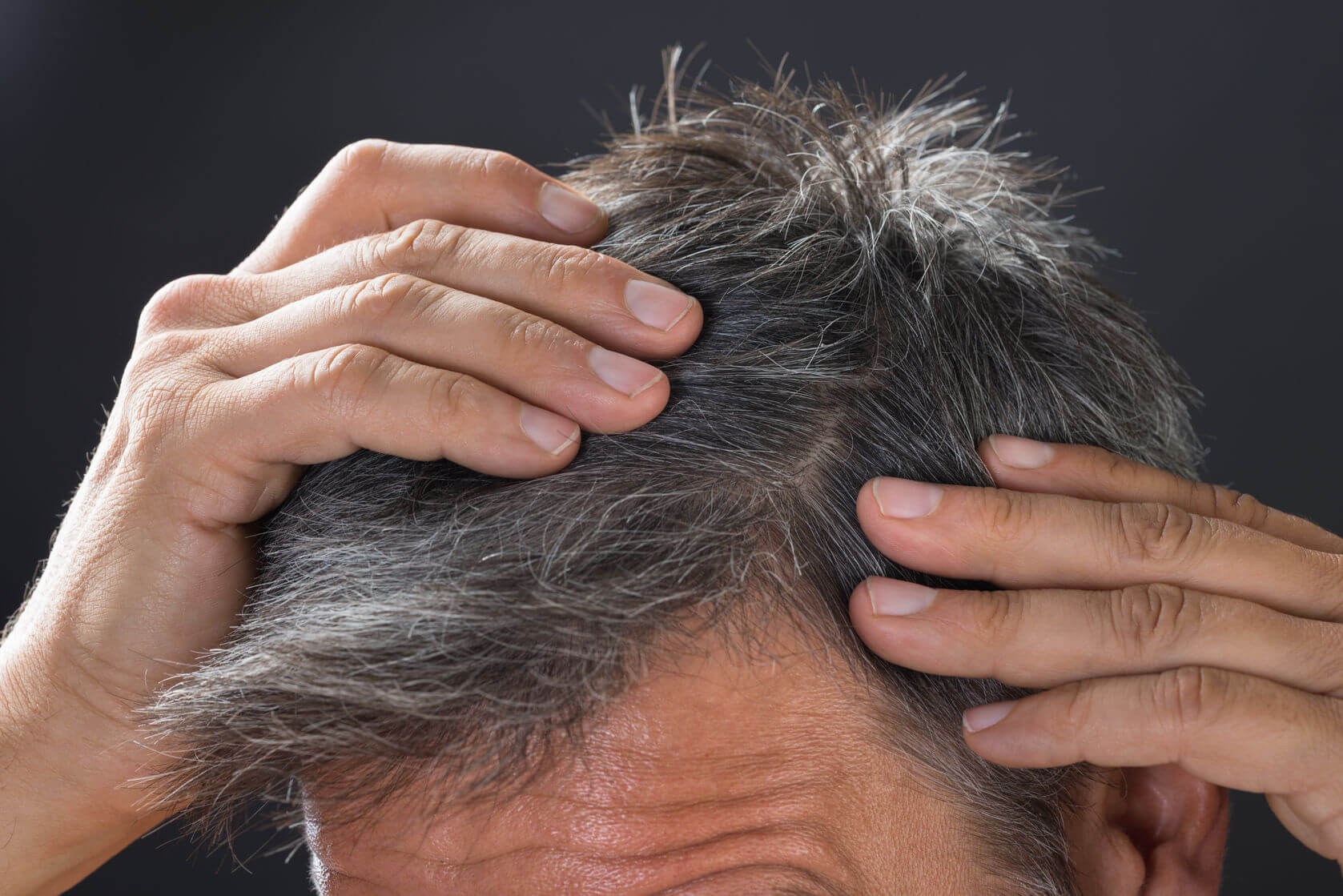 بیماری‌هایی که باعث ریزش موها می‌شوند - پرمطلب