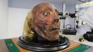 موزه اعضاء بدن انسان های معروف